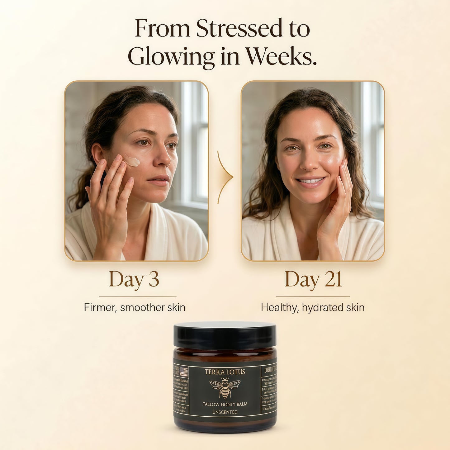 Terra Lotus - Organic Grass-Fed Beef Tallow Balm with Raw Honey - Moisturizing Cream for Soft, Smooth Skin - Handmade All-Natural Moisturizer (4 Oz, Lavender) Visit the Terra Lotus Store